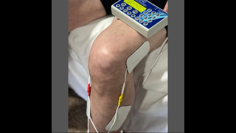 How Does Microcurrent Therapy Work? A Guide for Healthcare Practitioners