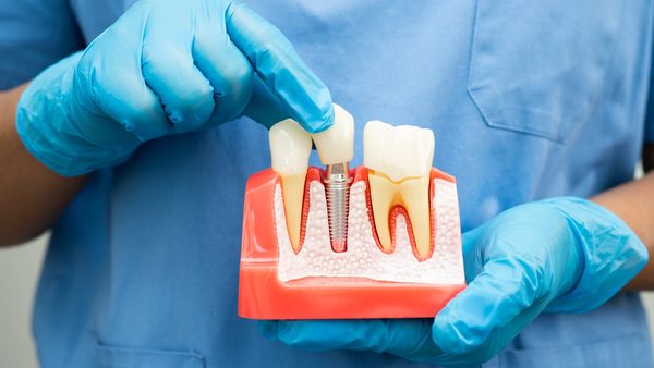 Arnold Dental Broadens Nottingham, UK Access To Care Aided By 3D Printing