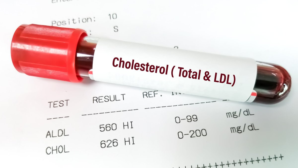 Does Low Testosterone Affect Cholesterol? Australia Experts Explain the Link