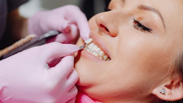 Are Veneers Worth It for Chipped Teeth? Nottingham Dentist Explains Benefits