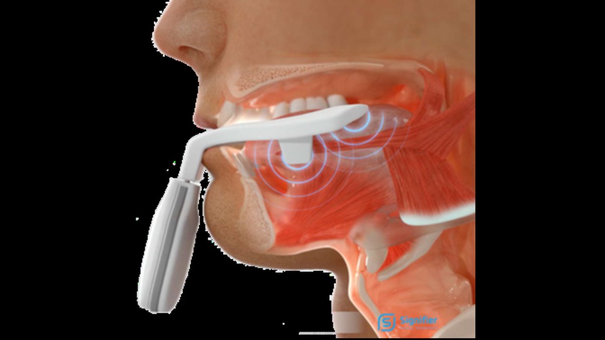 Camarillo FDA-Authorized Daytime Therapy for Mild Sleep Apnea & Snoring Expanded
