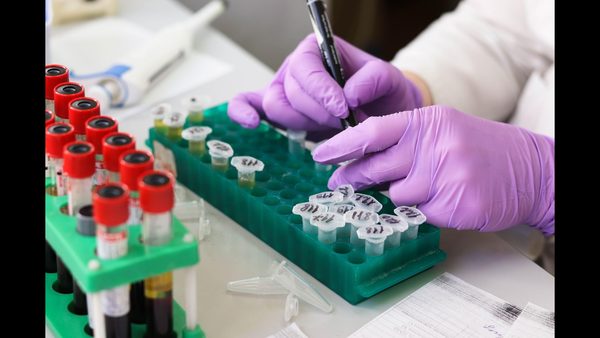 Can Blood Work Change in 6 Months? Health & Biomarker Shifts Explained