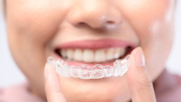 Clear Aligner Cost Breakdown: Frisco Experts Explain What Patients Pay For