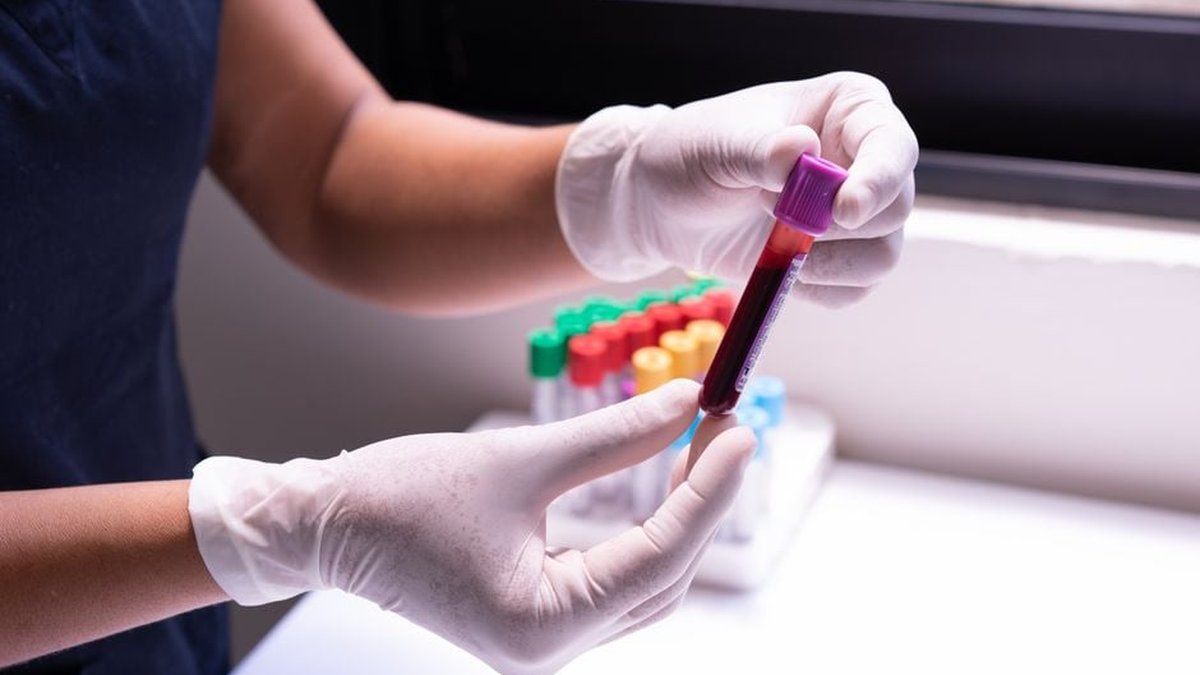 Functional Health Testing in Calgary: Types, Use Cases, and Benefits Explained