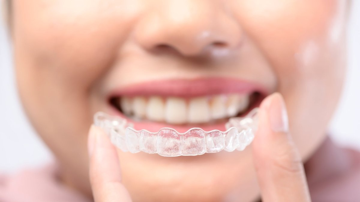 How Does Invisalign Work: Nottingham Dentist Explains the Treatment Process