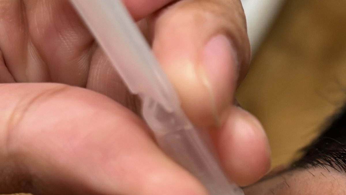 Jackson Heights Dry Eye Disease Treatment & Evaluation: Service Announced