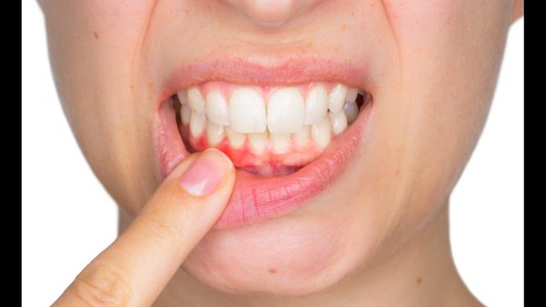 Oral Exams & Teeth Cleaning For Plaque Removal: Why Routine Care Is Crucial
