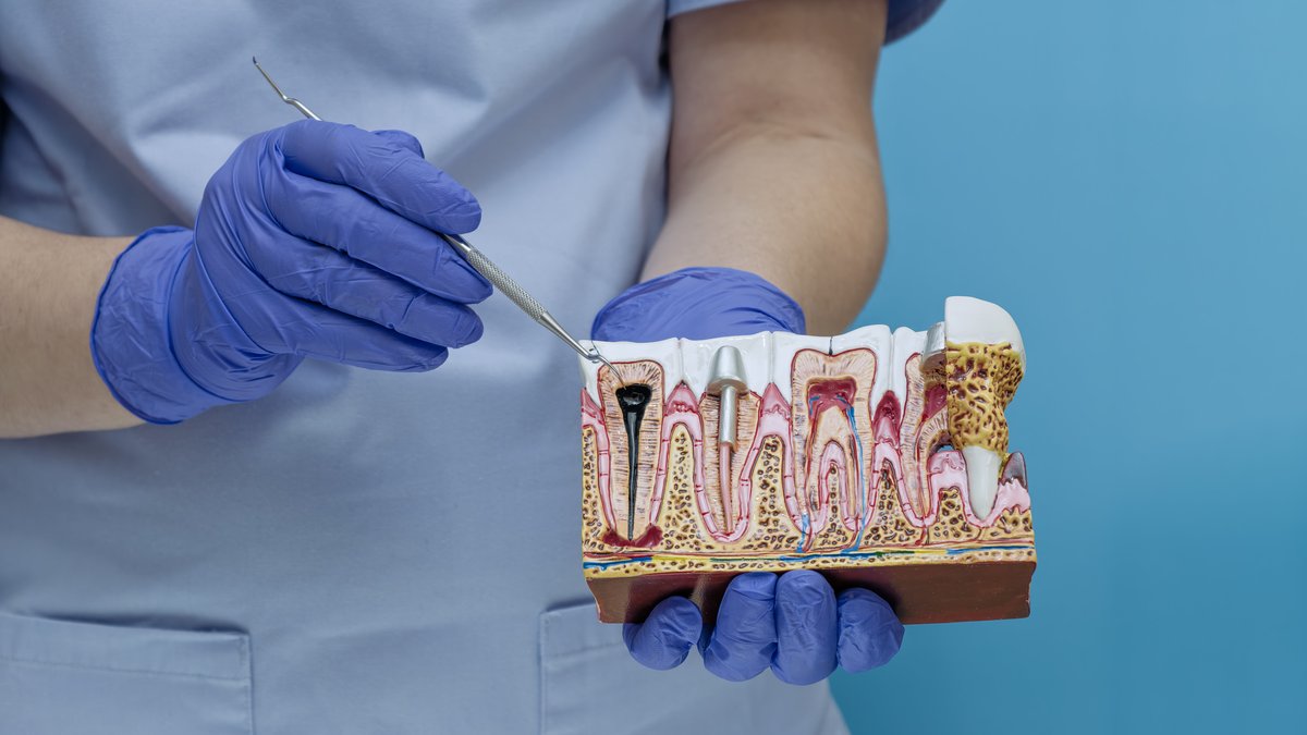 Root Canal Treatment in Nottingham: Prices, Procedure & Results