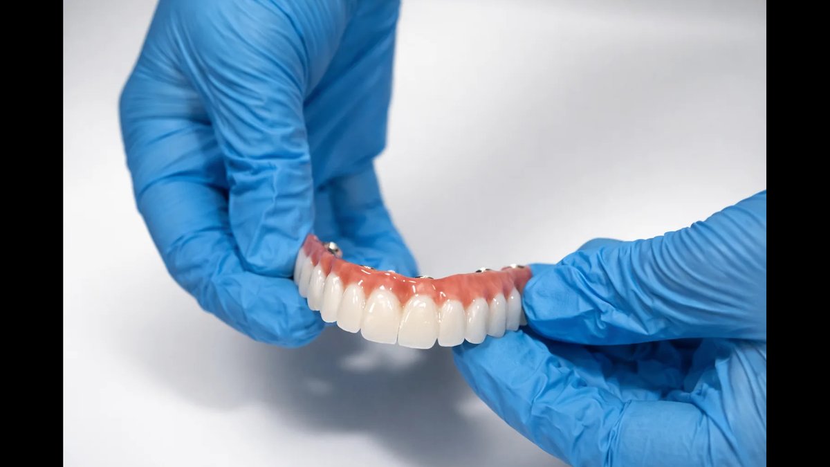 Lifetime Warranty for Zirconia Full-Arch Teeth: Coverage Guide Released