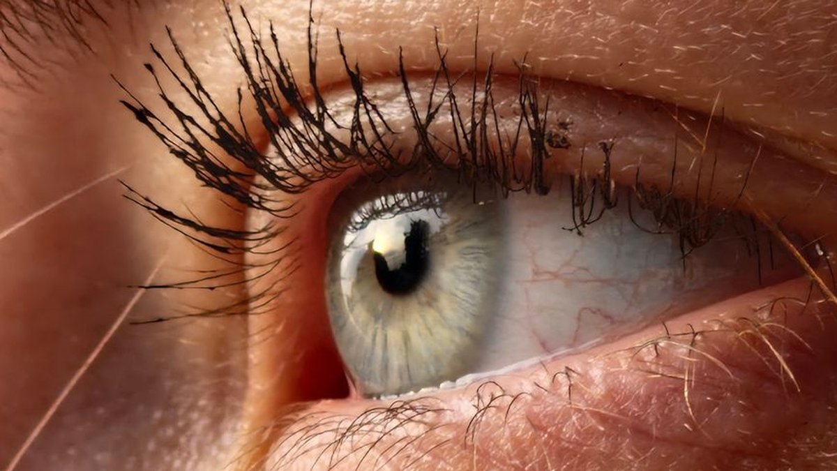 Digital Dry Eye: Canadian Expert Explains How Screen Time Affects Your Eyes