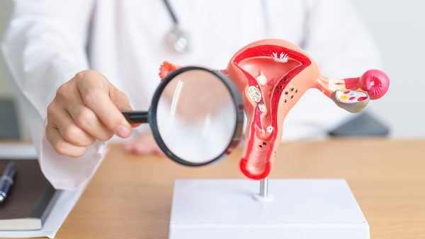 Naturopathic Treatment for Endometriosis: Diet, Lifestyle & Therapy Options