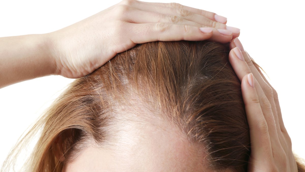 Top 3 Hair Growth Serums for Receding Hairlines: Prices, Ingredients & Results