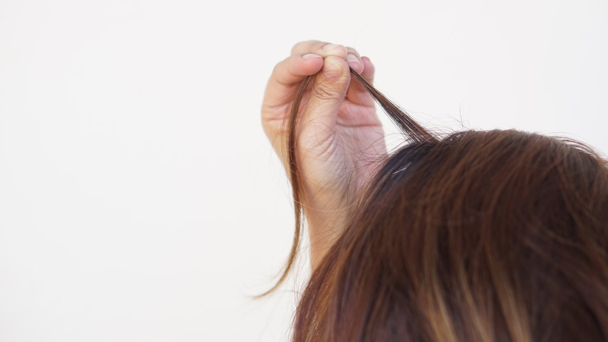 Trichotillomania Hair Pulling Causes & Treatment Options: Guide Released