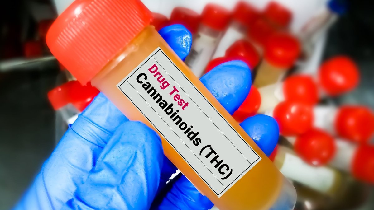 Workplace Drug Testing After Legalization: What Employers Need To Know In 2026