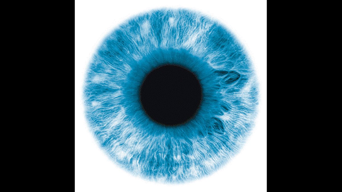 Canada Red Eyes Treatment Options: Dry Eye & Blepharitis Patient Guide Released