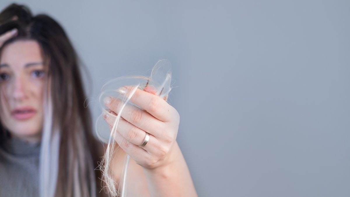 Hair Loss After Accutane: Causes And Treatment Revealed In New Guide