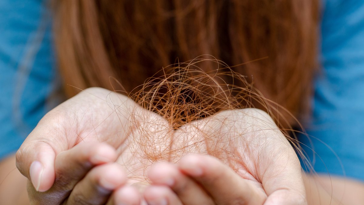Hair Loss Due To Hypothyroidism: Causes & Regrowth Potential