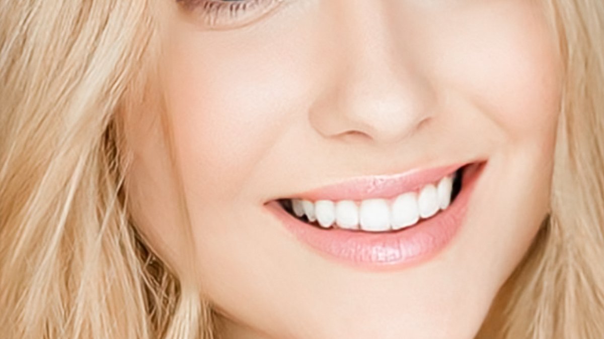 Teeth Whitening in Nottingham: Price Tiers & Best Options For Dental Patients